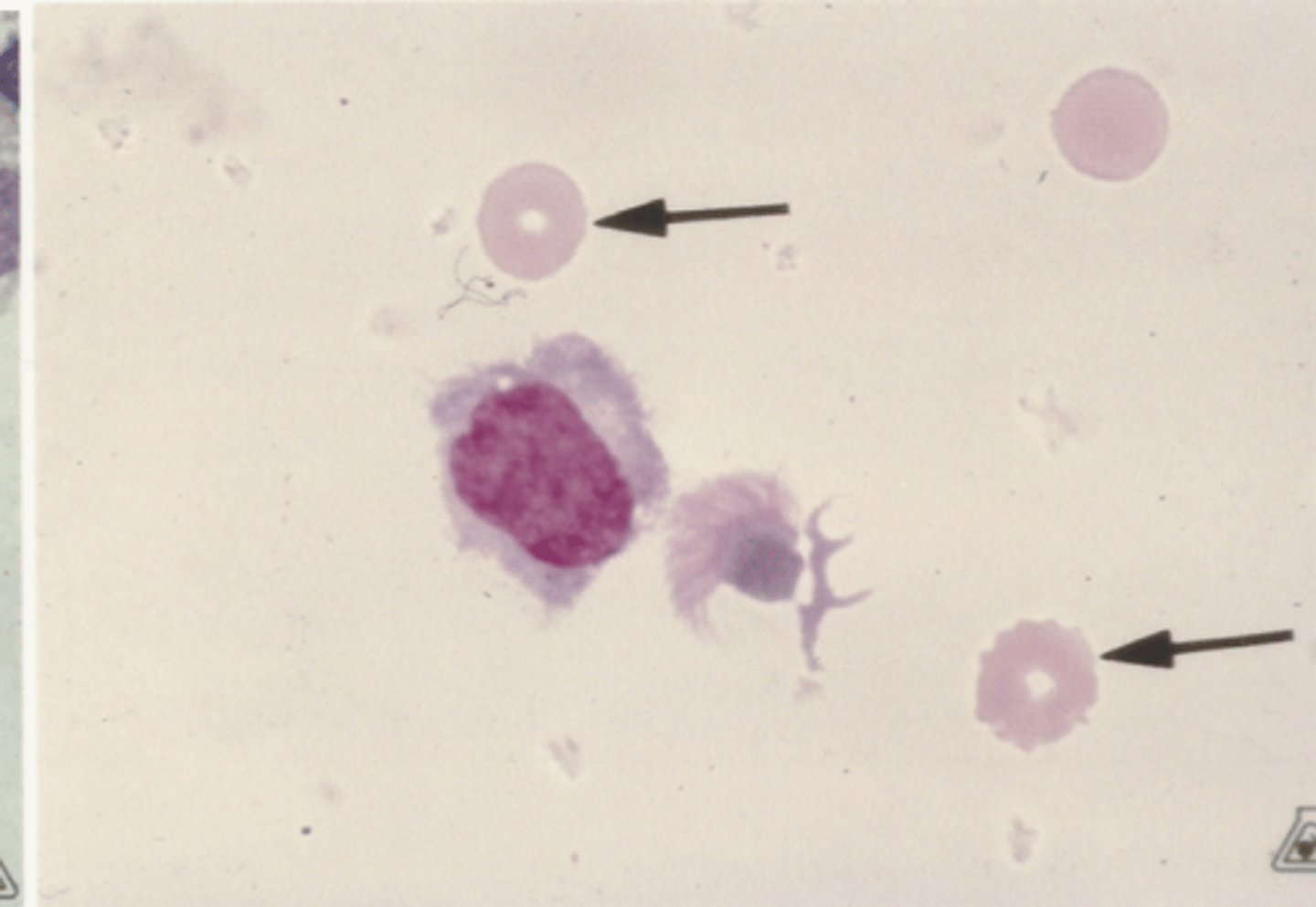 <p>Identify the cells in this body fluid</p>
