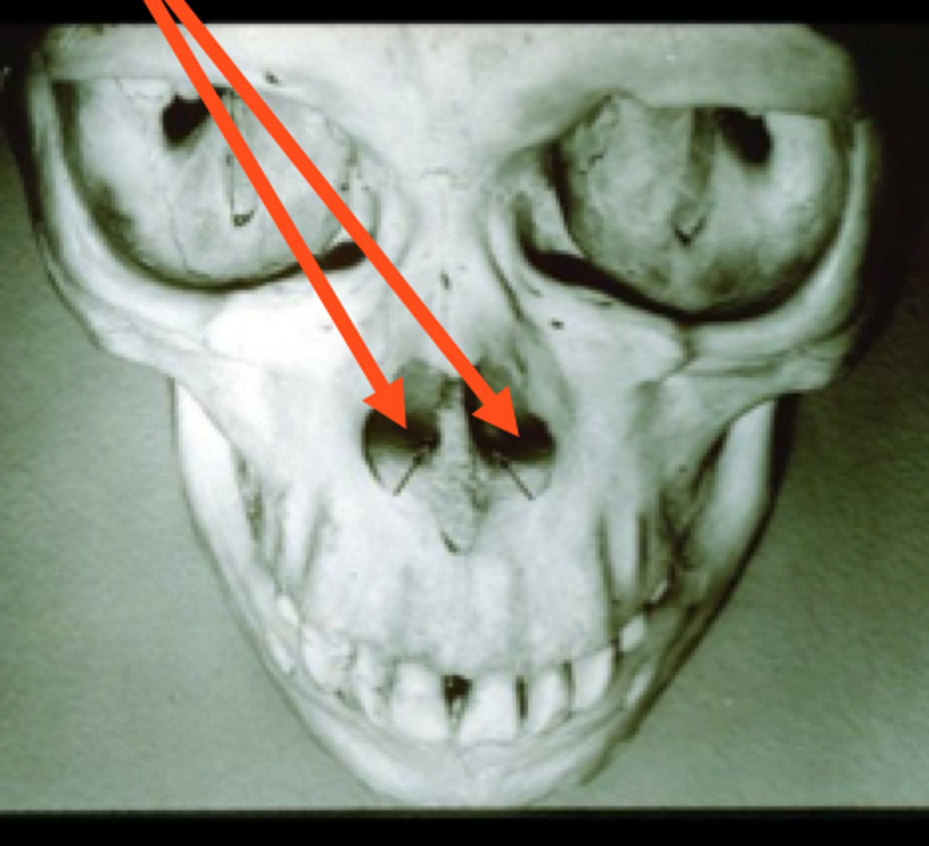 knowt flashcard image