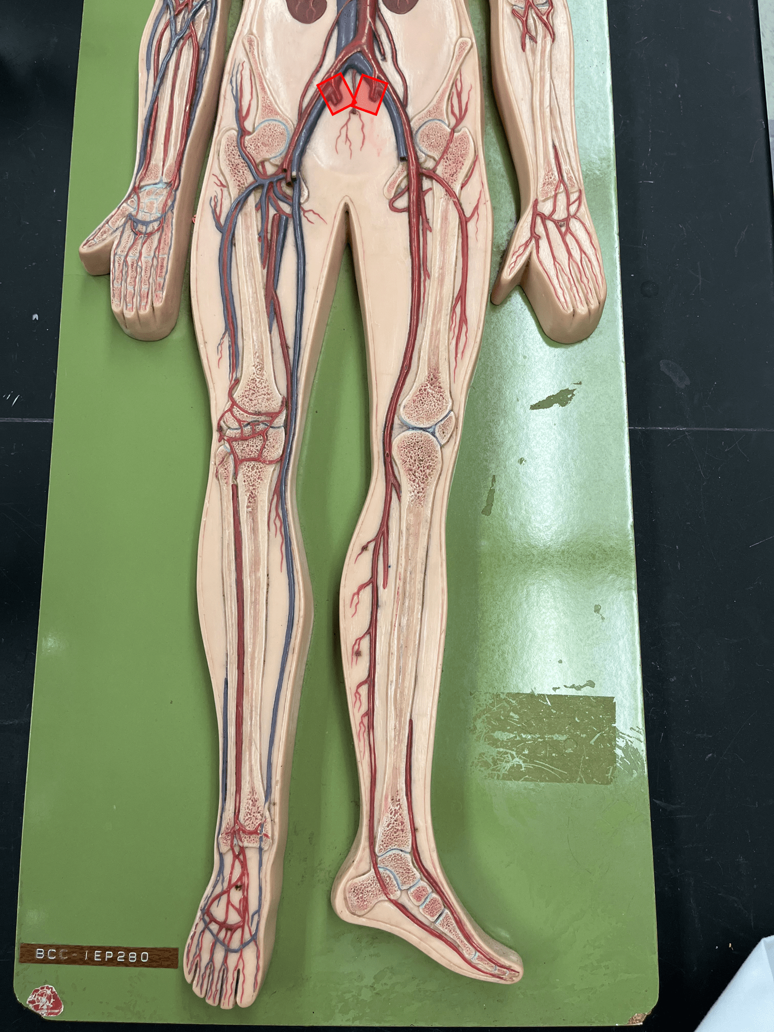 <p>• An artery of the lower limb.</p>
<p>• Originates from the common iliac artery.</p>
<p>• Supplies the pelvic wall and viscera.</p>