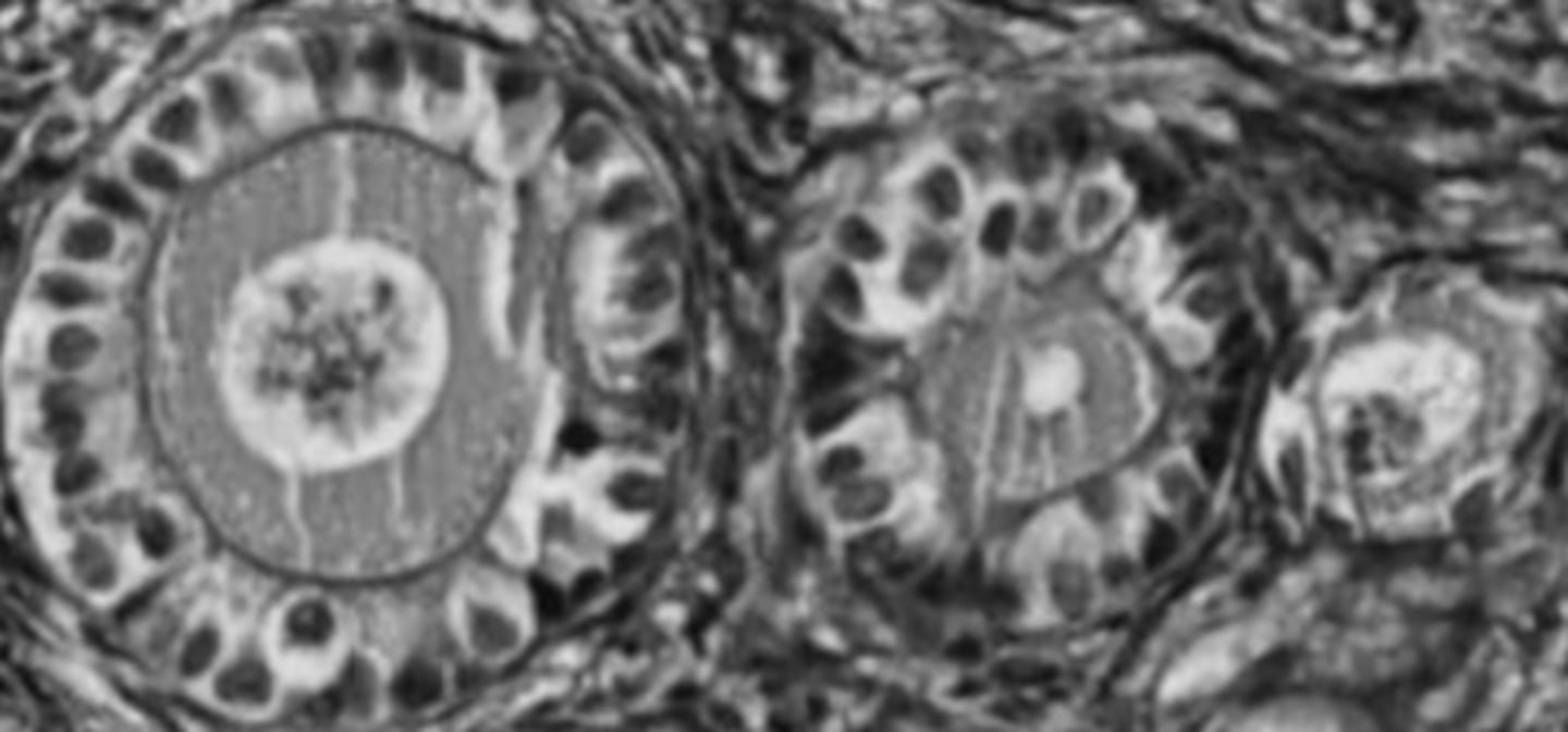 <p>What ovarian follicles appear in the image?</p><p>a) Primordial.</p><p>b) Primary.</p><p>c) Secondary.</p><p>d) Tertiary.</p>