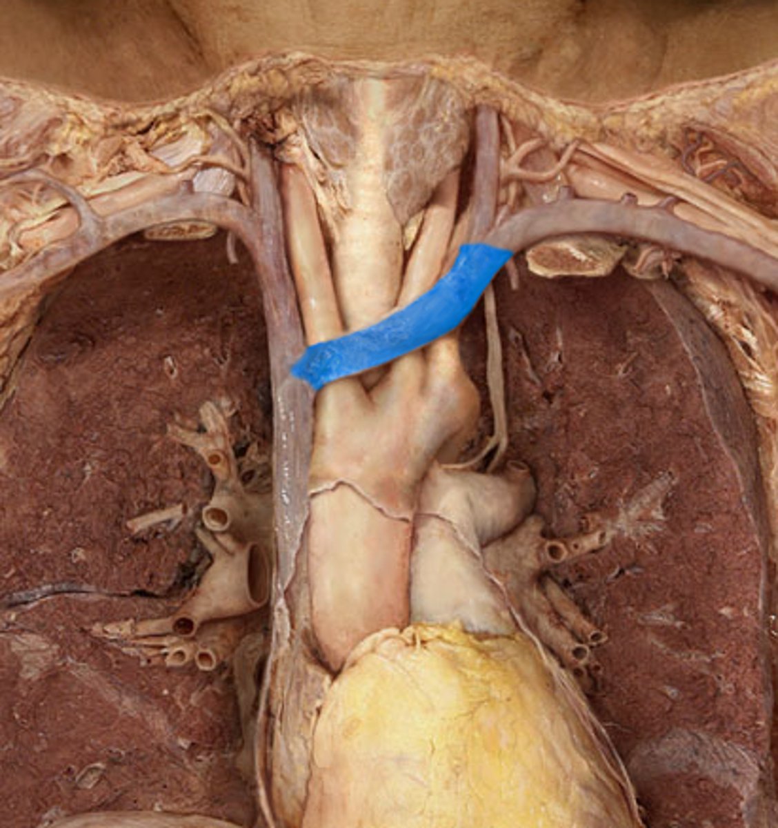 <p>Name the Vein</p>