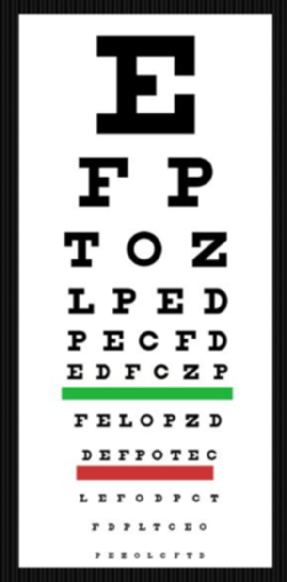 <p>missing one side of chart letters = VF defects</p>