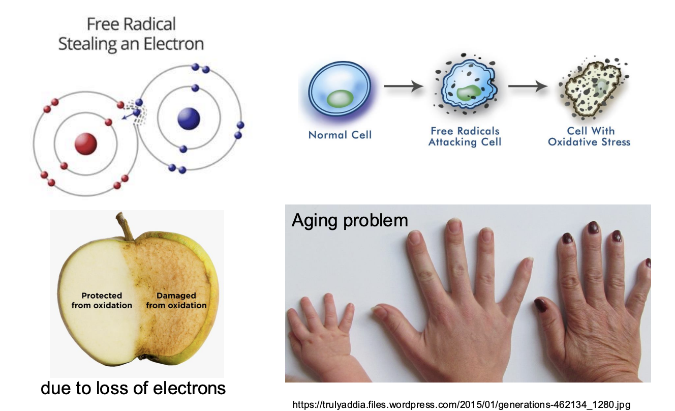 <ul><li><p><span style="background-color: inherit; line-height: 19.55px; color: windowtext;"><span>Free radical steal e- from other molecules -> cause dmg to cells and tissues</span></span><span style="line-height: 19.55px; color: windowtext;"><span> </span></span></p></li><li><p class="Paragraph SCXO105442103 BCX0" style="text-align: left;"><span style="background-color: inherit; line-height: 19.55px; color: windowtext;"><span>Naked eyes</span></span><span style="line-height: 19.55px; color: windowtext;"><span> </span></span></p><ul><li><p class="Paragraph SCXO105442103 BCX0" style="text-align: left;"><span style="background-color: inherit; line-height: 19.55px; color: windowtext;"><span>Apple slice oxidized (dmged from oxidation (lose of e-))</span></span><span style="line-height: 19.55px; color: windowtext;"><span> </span></span></p></li></ul></li><li><p class="Paragraph SCXO105442103 BCX0" style="text-align: left;"><span style="background-color: inherit; line-height: 19.55px; color: windowtext;"><span>Human aging caused by free radicals</span></span><span style="line-height: 19.55px; color: windowtext;"><span> </span></span></p><ul><li><p class="Paragraph SCXO105442103 BCX0" style="text-align: left;"><span style="background-color: inherit; line-height: 19.55px; color: windowtext;"><span>Using protection on skin and damaged by free radicals</span></span><span style="line-height: 19.55px; color: windowtext;"><span> </span></span></p></li></ul></li></ul><p></p>