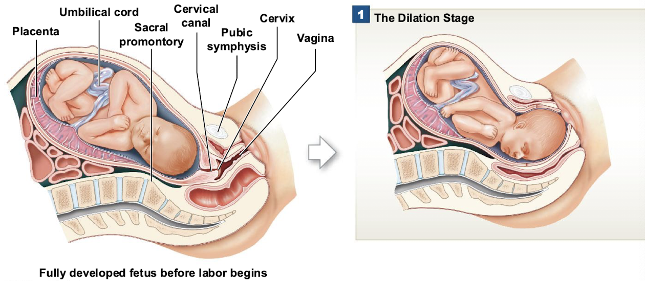 <ul><li><p>Cervix dilates, the fetus is pushed by muscular contractions into the cervical canal, and the amnion ruptures —<strong> water breaking </strong></p></li></ul><p></p>