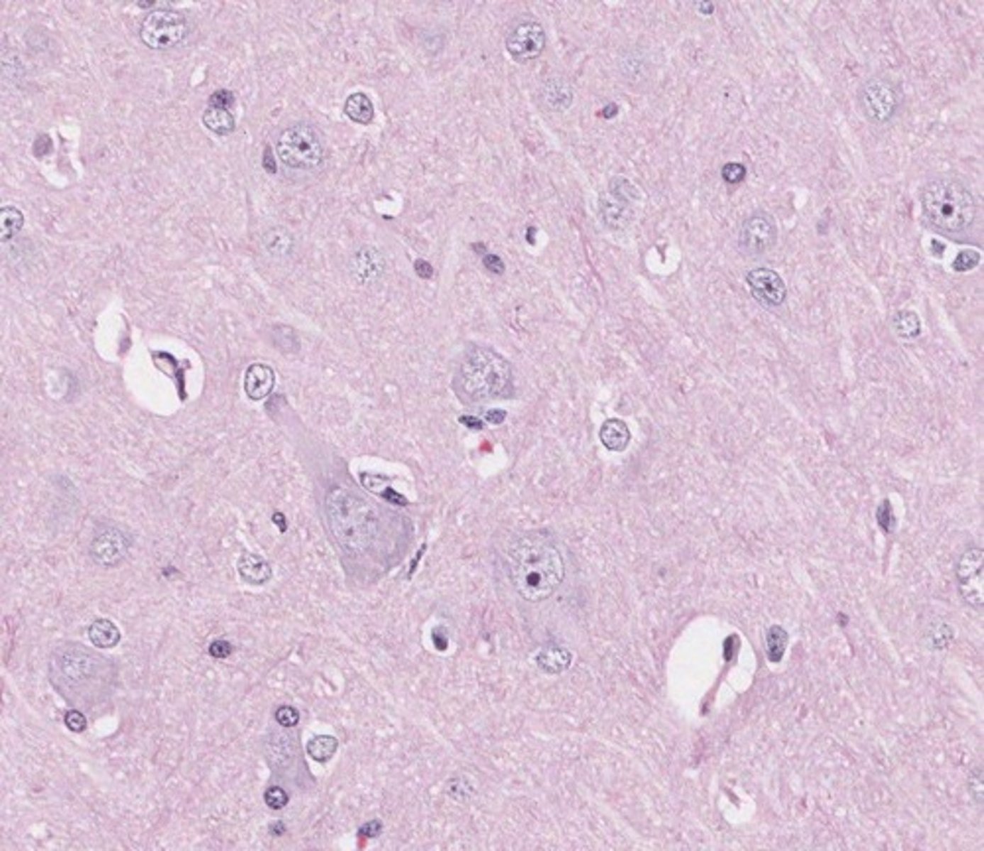 <p>H&amp;E staining is used, with astrocyte processes appearing brown due to GFAP expression.</p>