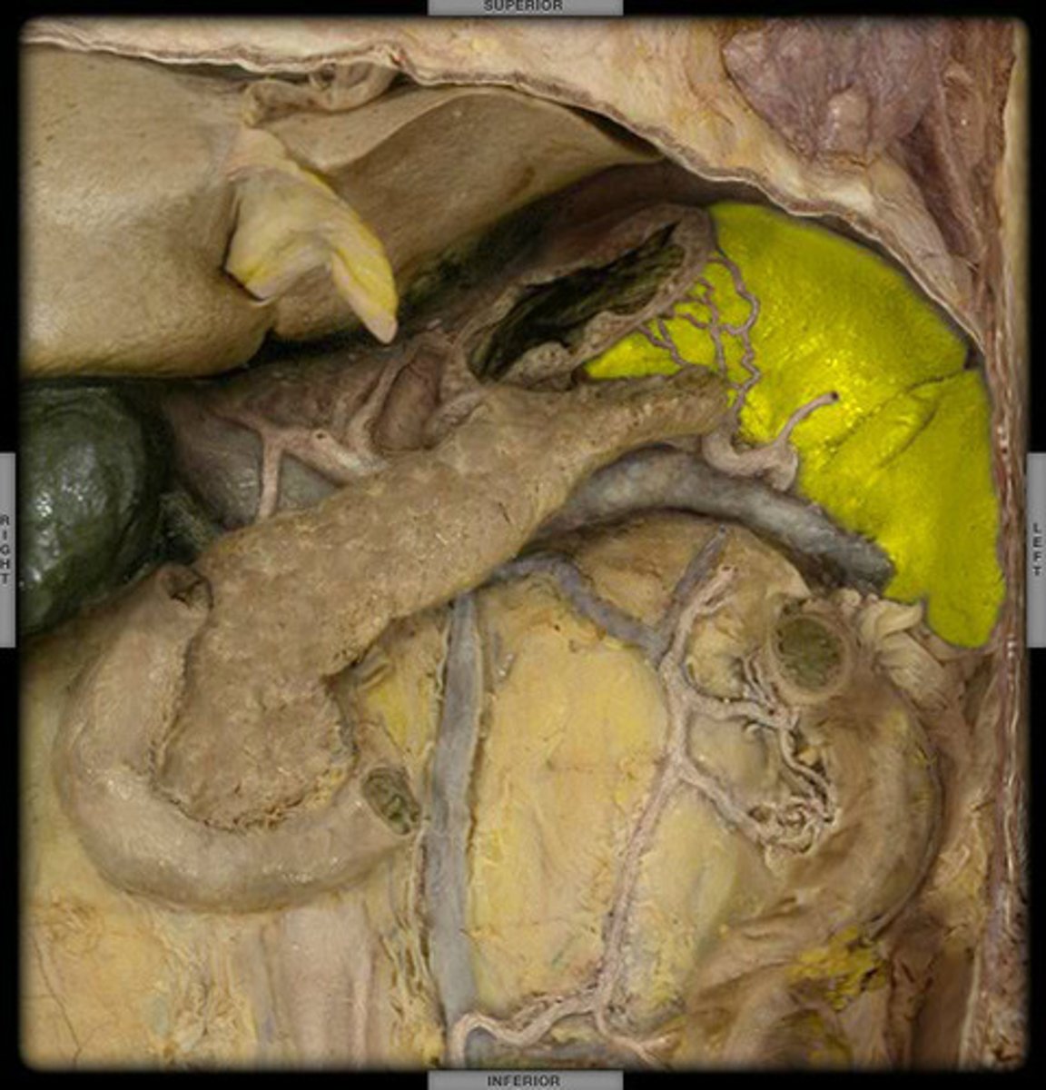 <p>Found in the left hypochondriac region between the fundus of the stomach and the diaphragm</p>