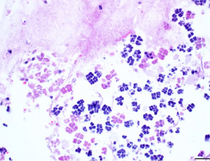 <p>What is the etiology?</p><p>A. Eimeria spp.</p><p>B. Sarcinia spp.</p><p>C. Clostridium spp.</p><p>D. Sarcocystis spp.</p>