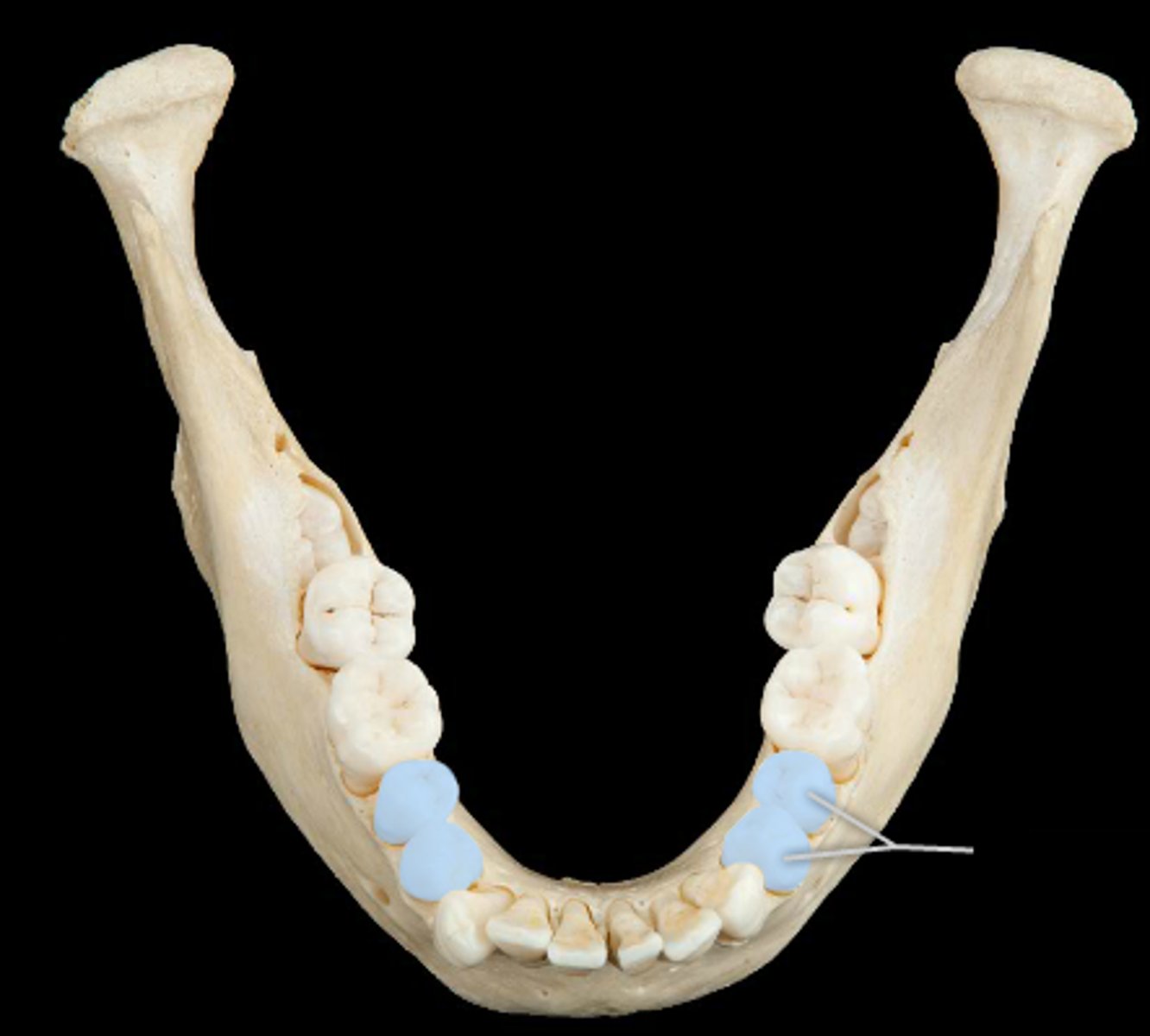 <p>The teeth located between canines and molars, used for crushing and grinding food.</p>