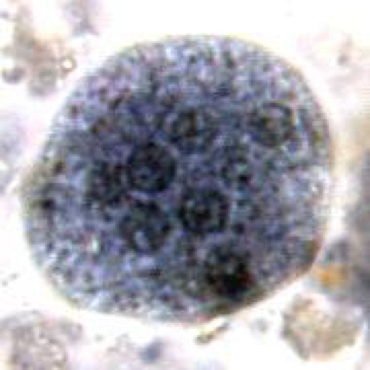 <p>Name the stage and species.</p><p>NOTE: Note chromatoidal bars present in immature cyst with splintered ends (not shown here). And the presence of EIGHT nuclei.</p>