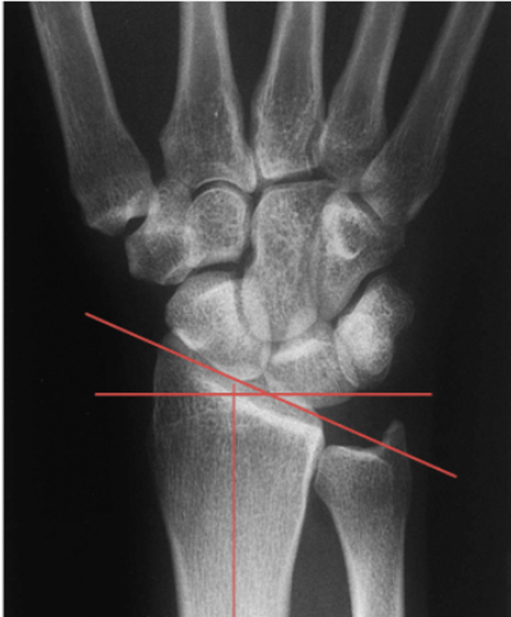 <p>What structure is highlighted?</p>