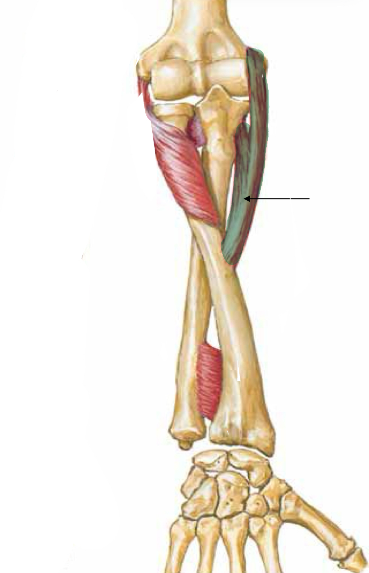 <p>What muscle is indicated?</p>