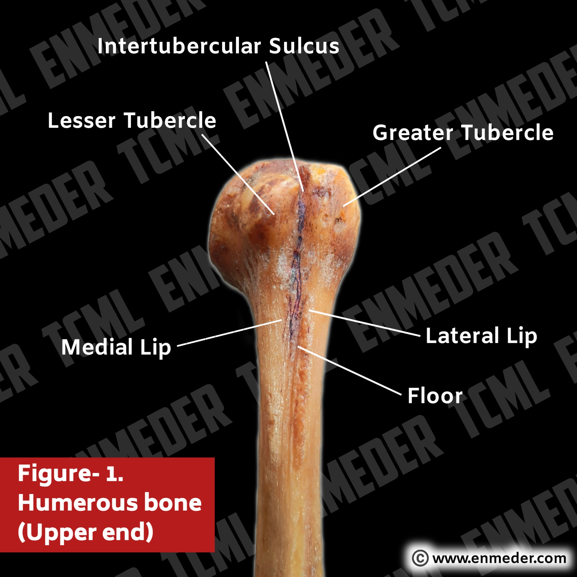 <p>where is the bicipital groove?</p>