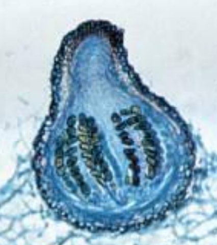 <p>-”buteleczki”<br>-otwór na szczycie (ostiola)<br>-jest hymenium i na nim osadzone worki<br>-mogą być w pełni na powierzchni lub schowane <br>-mogą znajdować się na podkładce (struktura “udająca” owocnik) - <em>Claviceps purpurea</em></p><p>-np. <em>Sordaria </em>sp. <em>Podospora </em>sp., <em>Nectria </em>sp., <em>Chaetomium </em>sp.</p>