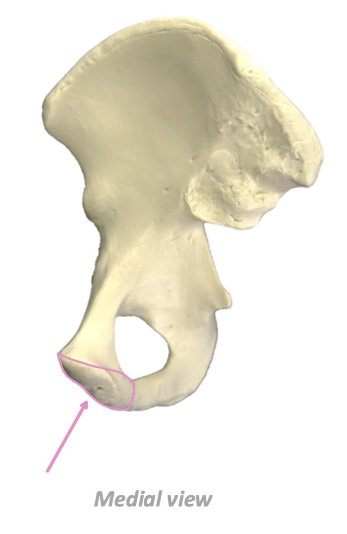 term image