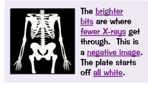 <ul><li><p>Radiographers in hospitals take X-ray 'photographs' of people to see if they have any broken bones.</p></li><li><p>X-rays pass easily through flesh but hot so easily through denser material like bones or metal. So it's the amount of radiation that's absorbed (or hot absorbed) that gives you an X-ray image.</p></li><li><p>Radiographers use X-rays and gamma rays to treat people with cancer (radiotherapy). This is because high doses of these rays kill all living cells - so they are carefully directed towards cancer cells, to avoid killing too many normal, healthy cells.</p></li></ul><p></p>