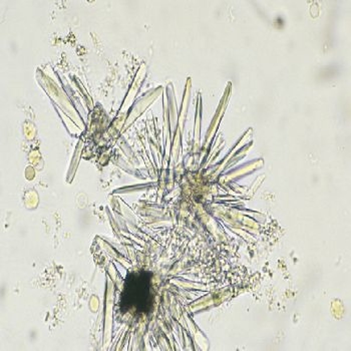 <p>alkaline urine, thin prisms, flat rectangles, colorless</p>