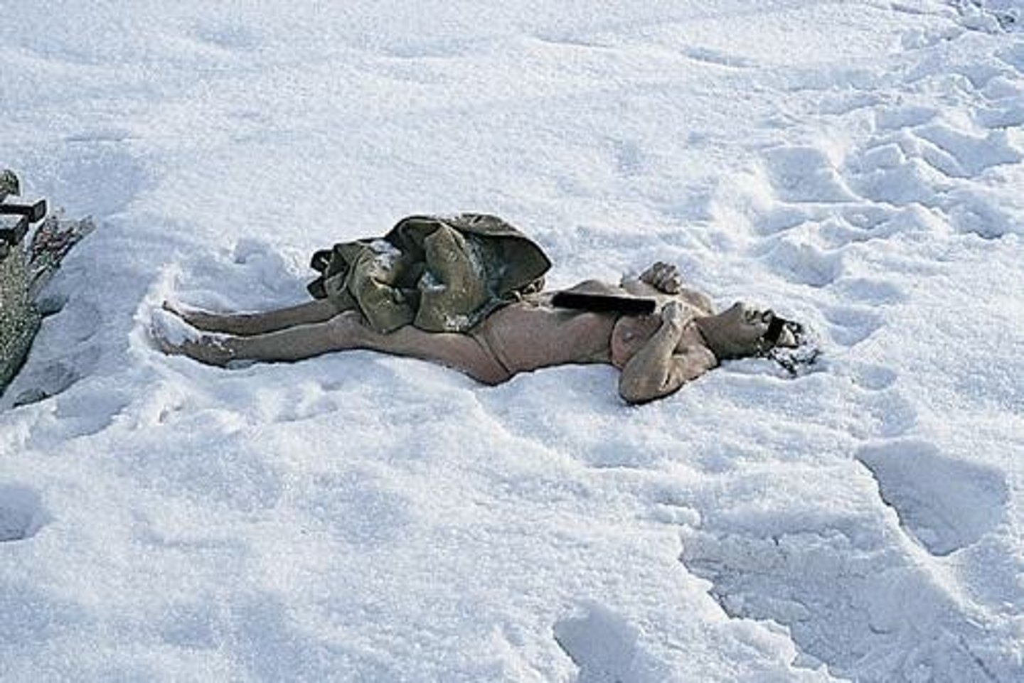 <p>Removal or partial removal of clothing in hypothermia, which may suggest sexual assault.</p>