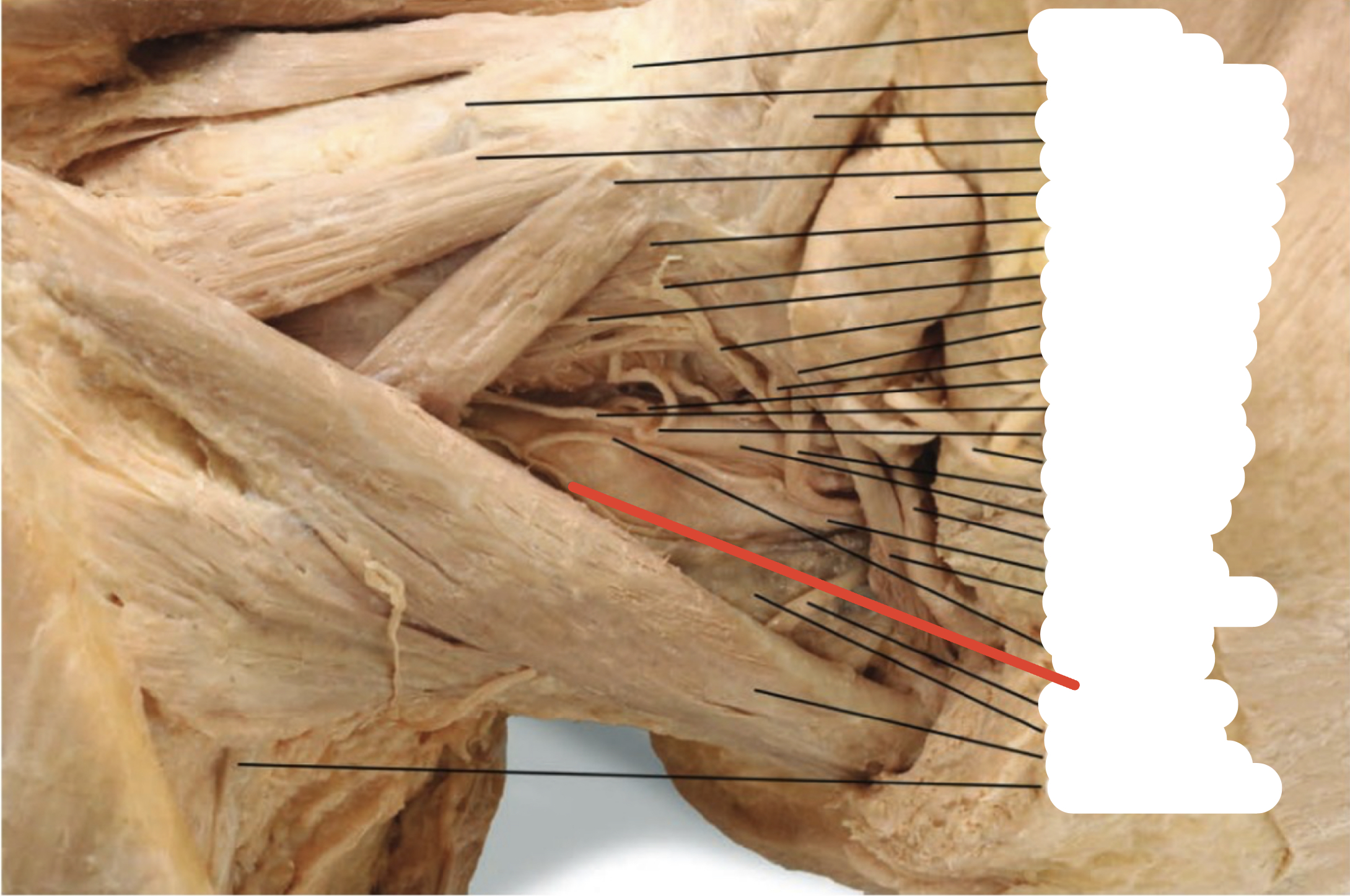 Identify the structure (red line)