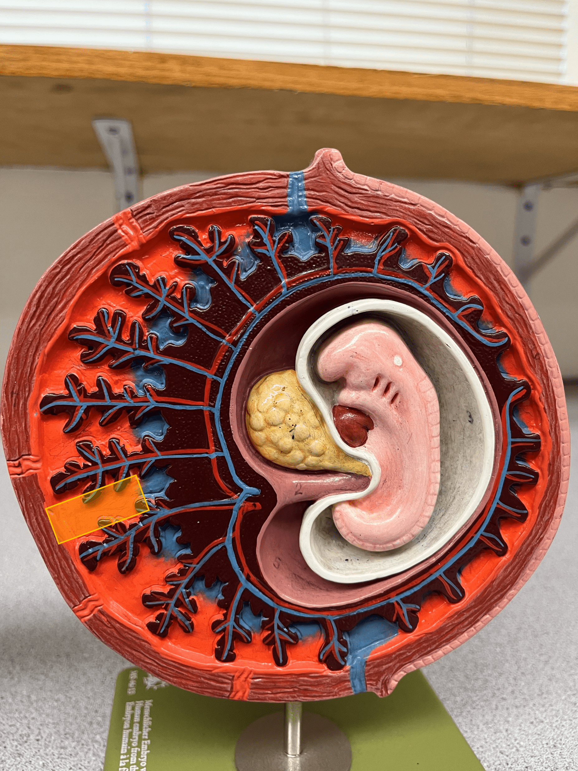 • Model of the 30-day embryo.

• The maternal portion of the placenta that exchanges nutrients and wastes with chorionic villi vessels.

• Also known as a placental sinus.