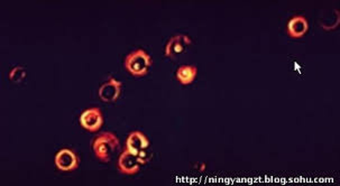 <p>ID Cx stain/bug/Pt/Dx</p>