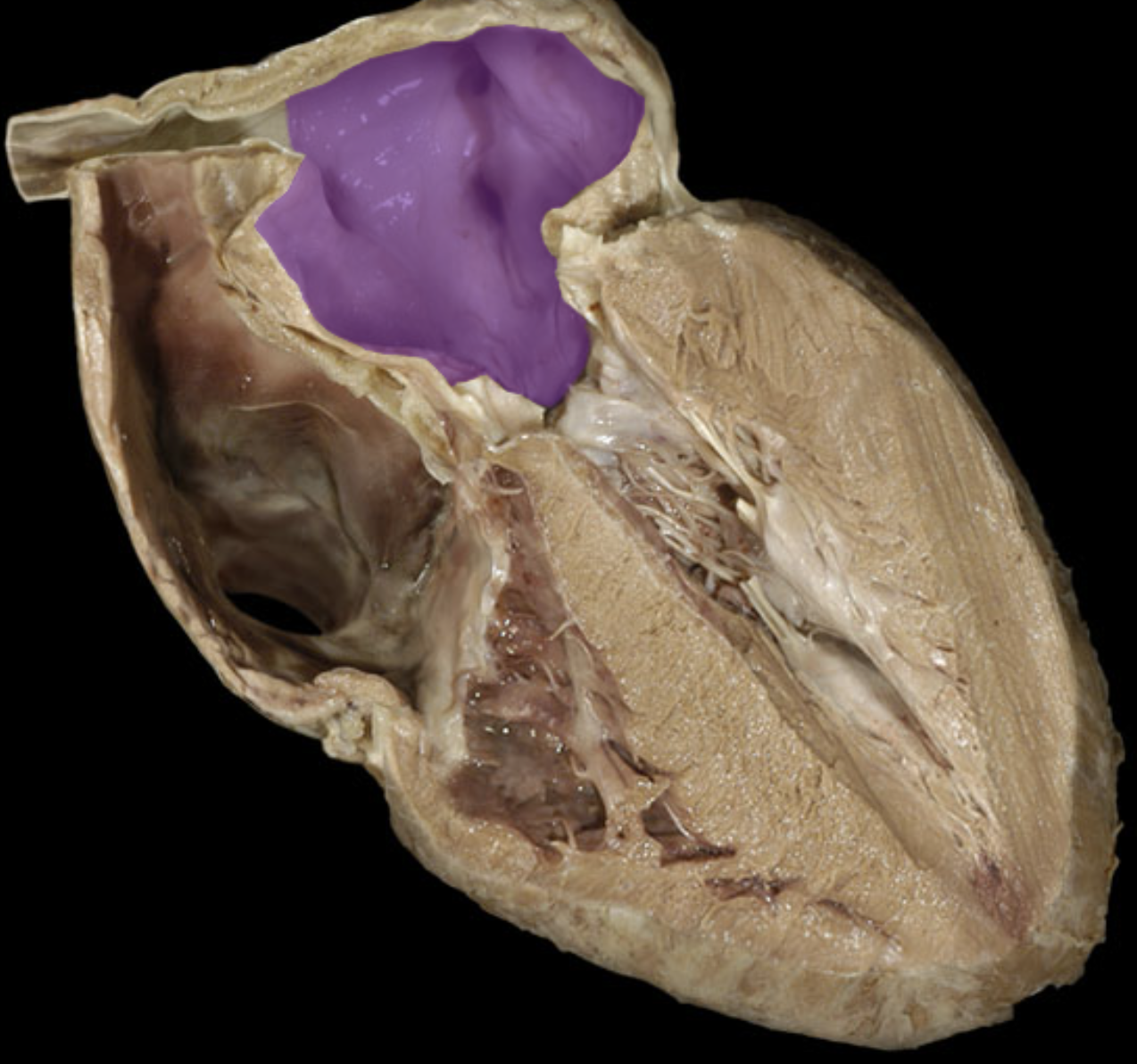 <p>Left atrium </p>