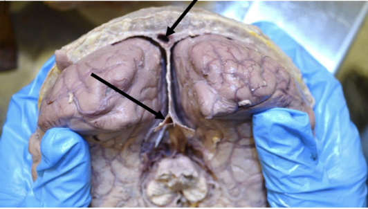 <p>venous channels between the two layers of the dura mater</p>