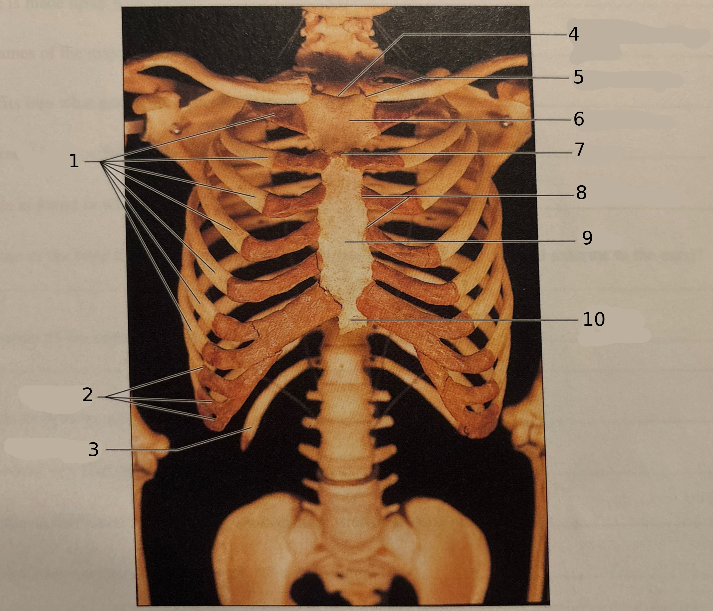<p>#5</p>