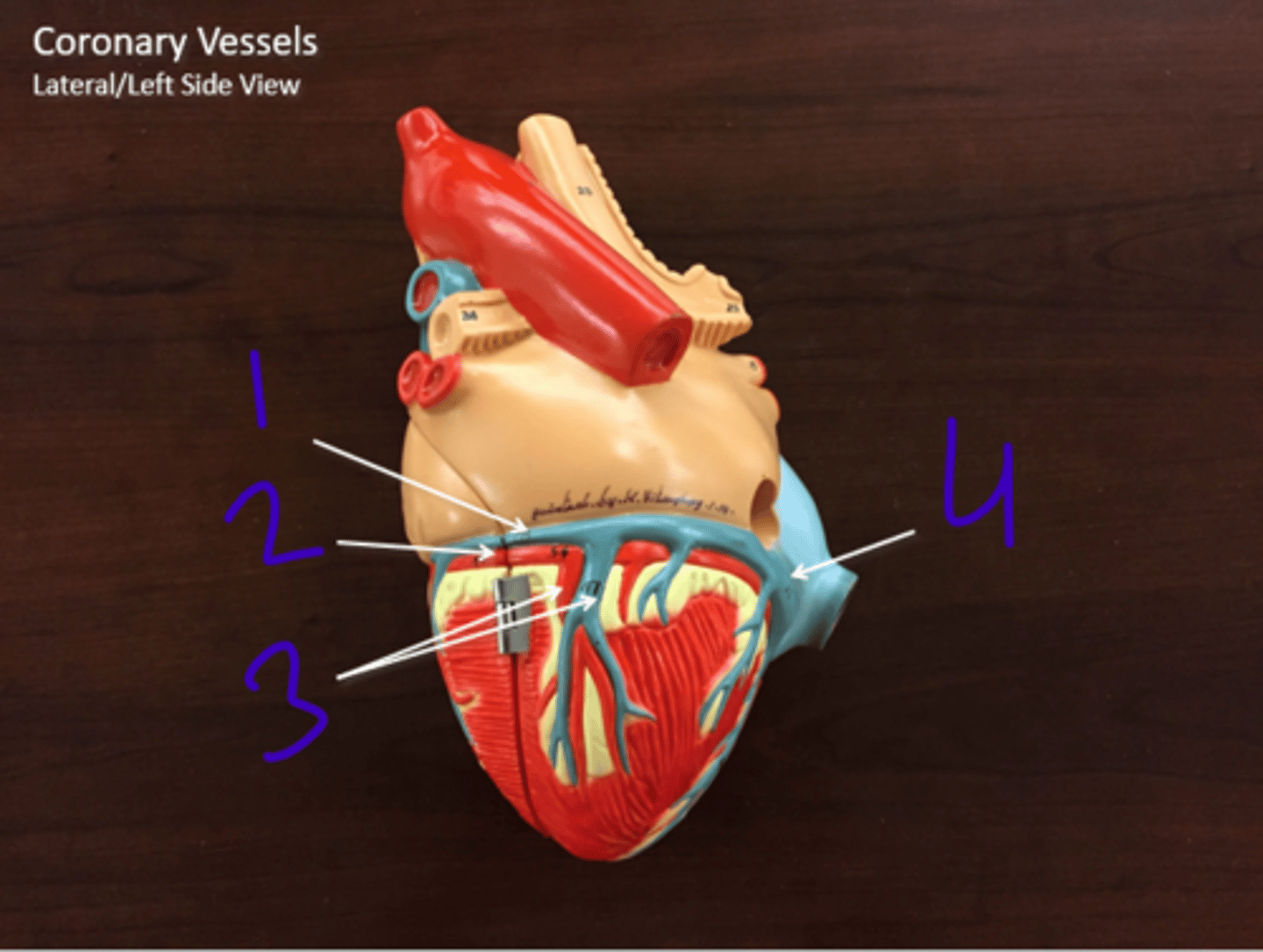 <p>Coronary vessels (lateral/left side view) - #2</p>