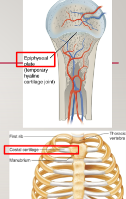 <p>sternocostal joint vs epiphyseal plate</p>