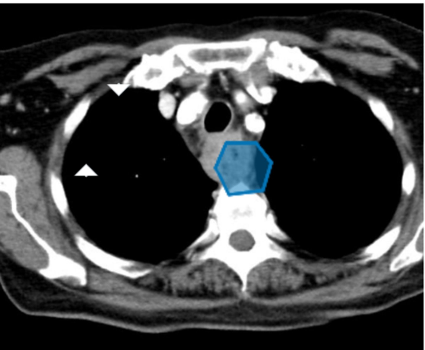 <p>Label pathology in image below</p>