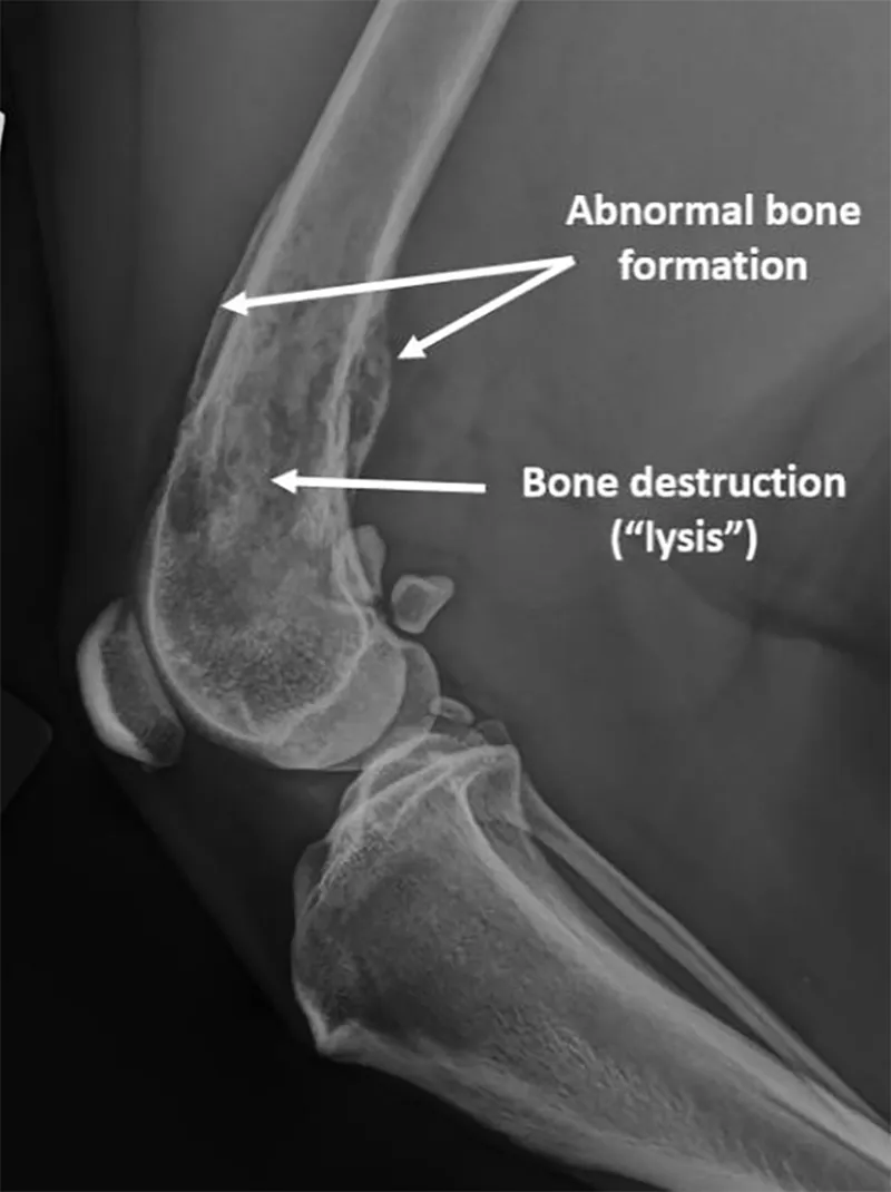 <ol><li><p><strong>bone loss (osteolysis)</strong></p><ul><li><p>osteoporosis (reduced mineral components and osteoid (bone matrix) in adult dog)</p></li><li><p>osteomalacia (insufficient mineralisation of the organic osteoid in young dog)</p></li><li><p>focal bone loss patterns (neoplasia)</p><ul><li><p>osteosarcoma - form of osteolysis, type of malignant neoplasia → bone loss.</p></li></ul></li></ul></li><li><p><strong>bone production (hypertrophy) </strong></p><ul><li><p>sclerosis </p></li><li><p>bigger trabeculae</p></li><li><p>superimposed periostal or endostal reaction</p></li></ul></li></ol><p></p>
