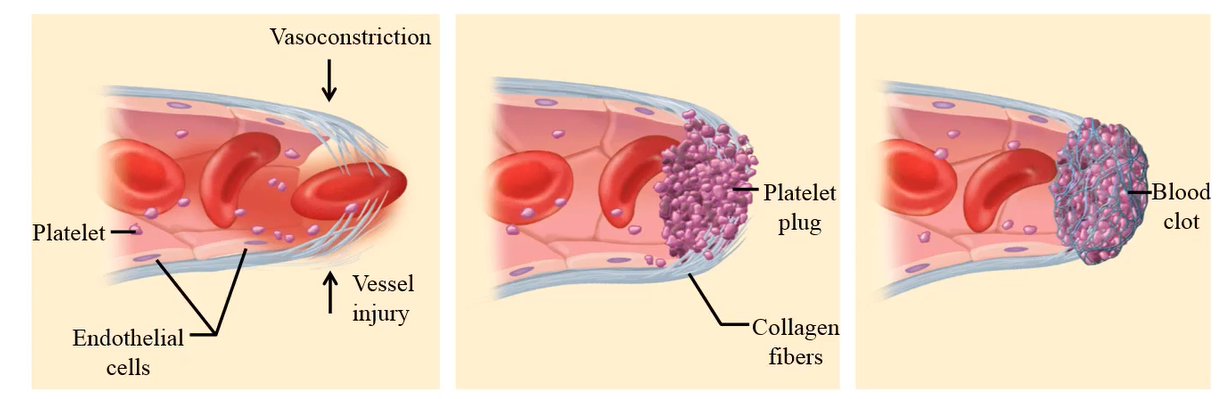 <p>Vasoconstriction, primary hemostasis or platelet plug, secondary hemostasis or blood clotting/coagulation (red thrombus)</p>