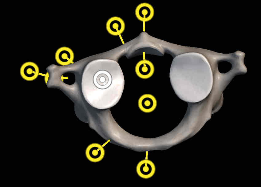 <p>Name this structure </p>