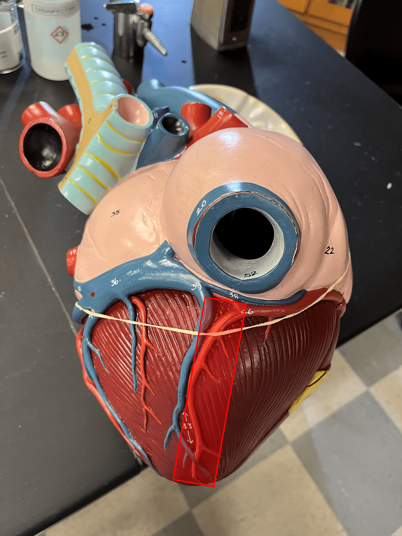 • Part of the coronary circulation.

• Located in and supplies the tissue around the posterior interventricular sulcus.

• One of the branches of the right coronary arteries.