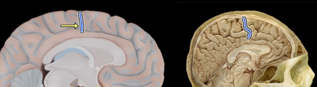 <p>Location:</p><ul><li><p>Lateral aspect of cerebral hemisphere</p></li></ul><p>Description:</p><ul><li><p>Groove on lateral surface of each cerebral hemisphere</p></li><li><p>Forms boundary between frontal and parietal lobes</p></li><li><p>Located between precentral and postcentral gyri</p></li></ul><p></p>
