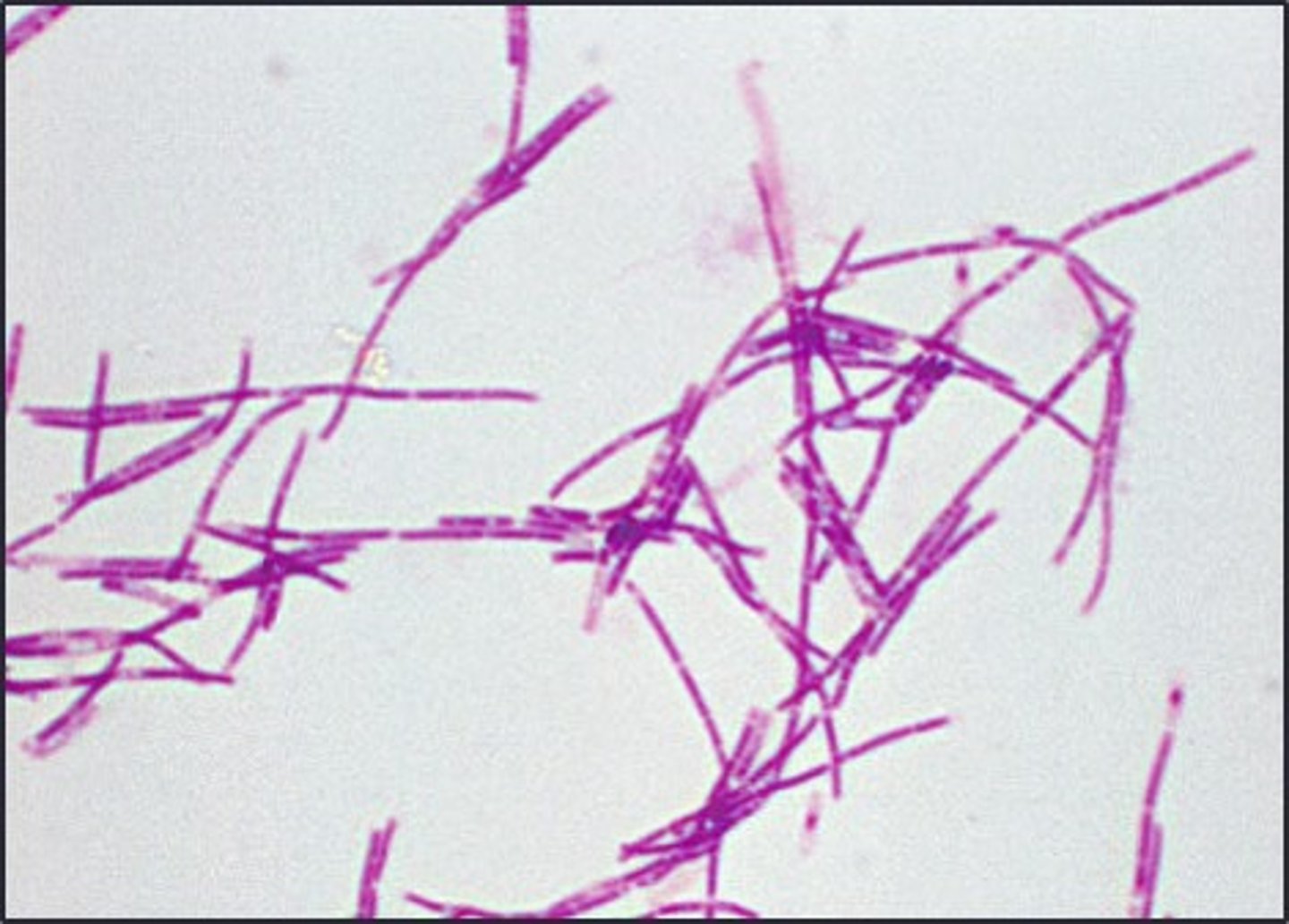 <p>This is gram negative</p>