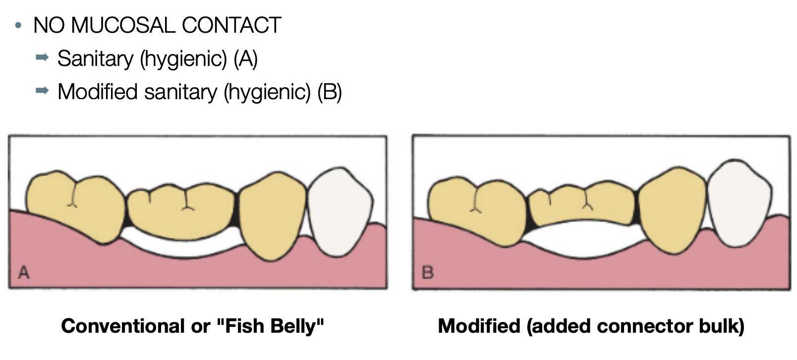 <ul><li><p>sanitary (hygienic) </p></li><li><p>modified sanitary (hygienic)</p></li></ul><p></p>