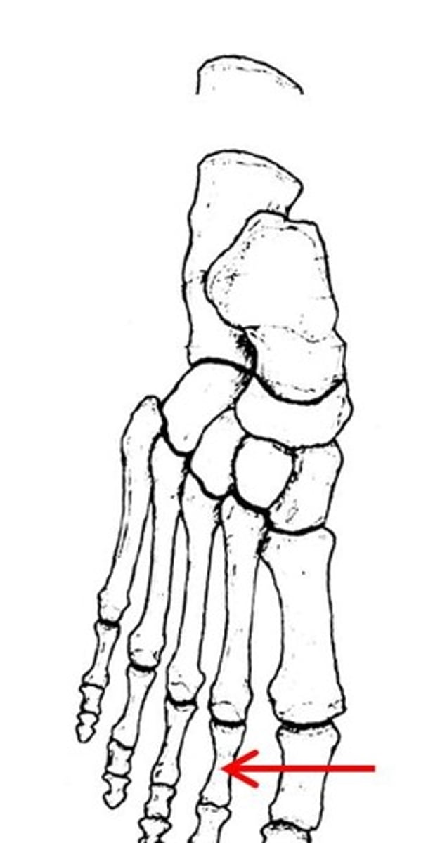 <p>ID specific bone</p>