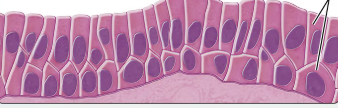 <p>what type of epithelium is this?</p>