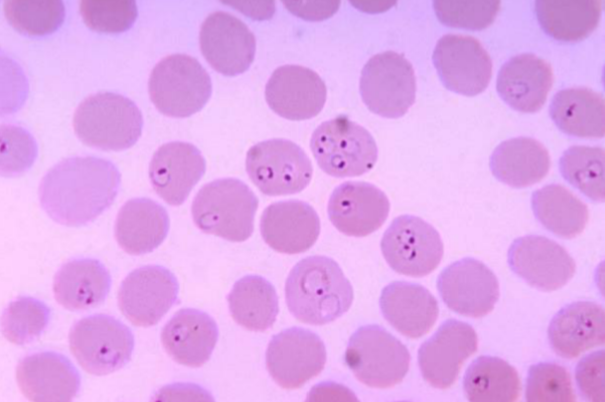 <p><em>Plasmodium</em> —</p><p>What disease does it cause?</p><p>How is it transmitted?</p><p>What is it’s method of motility?</p><p>What phylum does it belong to?</p>