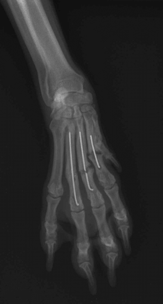 <p>what condition is this?</p>