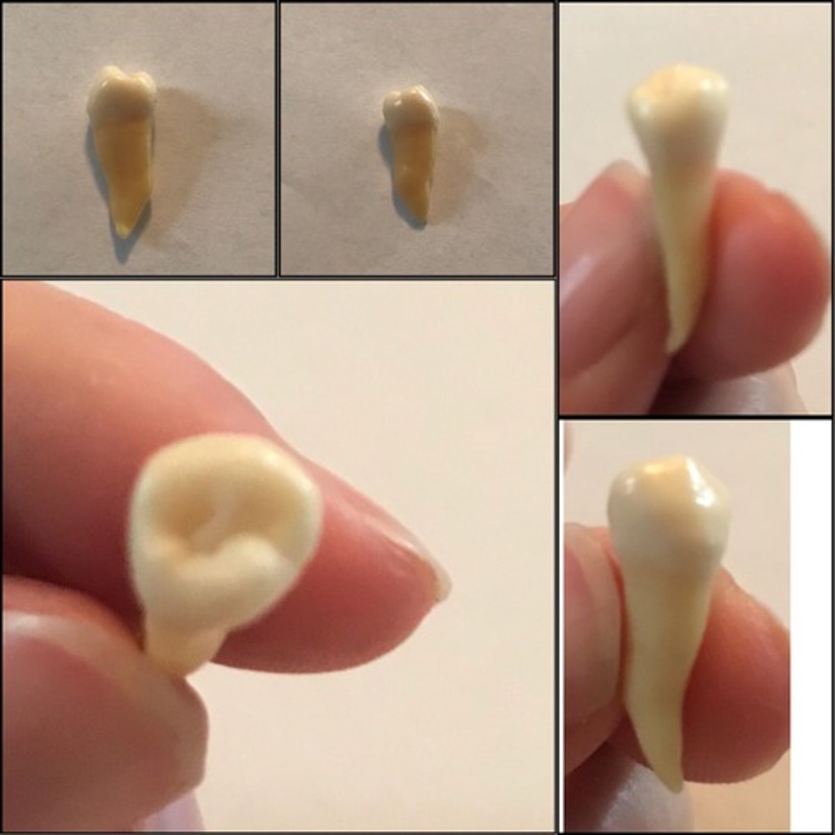 <p>What tooth is this ?</p>