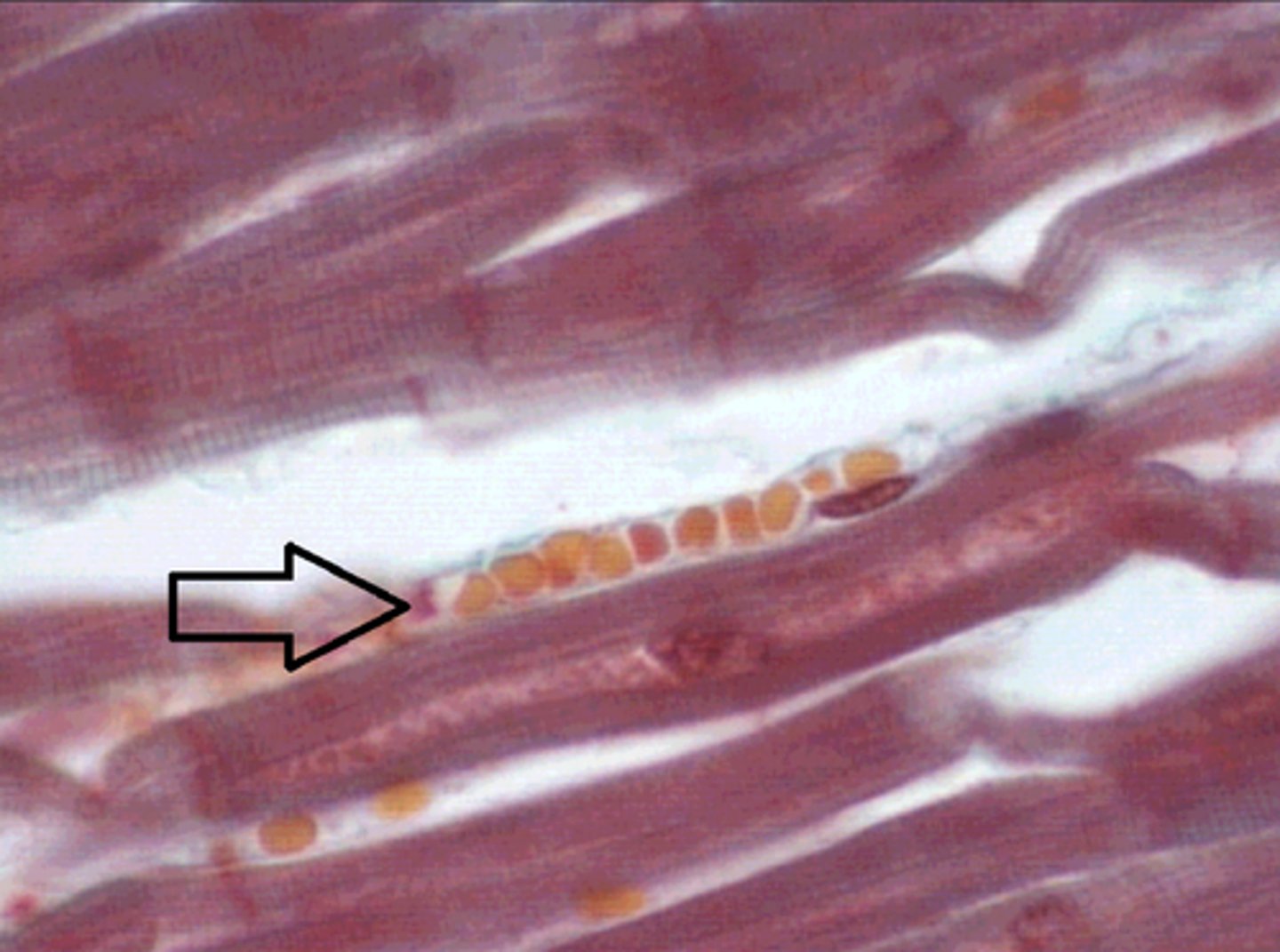 <p>Identify the structure at the arrow?</p>