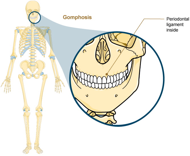 <p>A <span><strong><span>gomphosis</span></strong></span>, which means "fastened with bolts" is the specialized fibrous joint that anchors the root of a tooth into its bony socket <strong>(Figure 4.14)</strong> </p><p></p><p>Gomphoses occur within the maxillary or mandible bones of the skull. </p><p></p><p>Spanning between the bony walls of the socket and the root of the tooth are numerous short bands of dense connective tissue, each of which is called a <span><strong><span>periodontal ligament</span></strong></span>.</p><p></p><p> Due to the immobility of a gomphosis, this type of joint is functionally classified as a <em>synarthrosis</em>.</p>