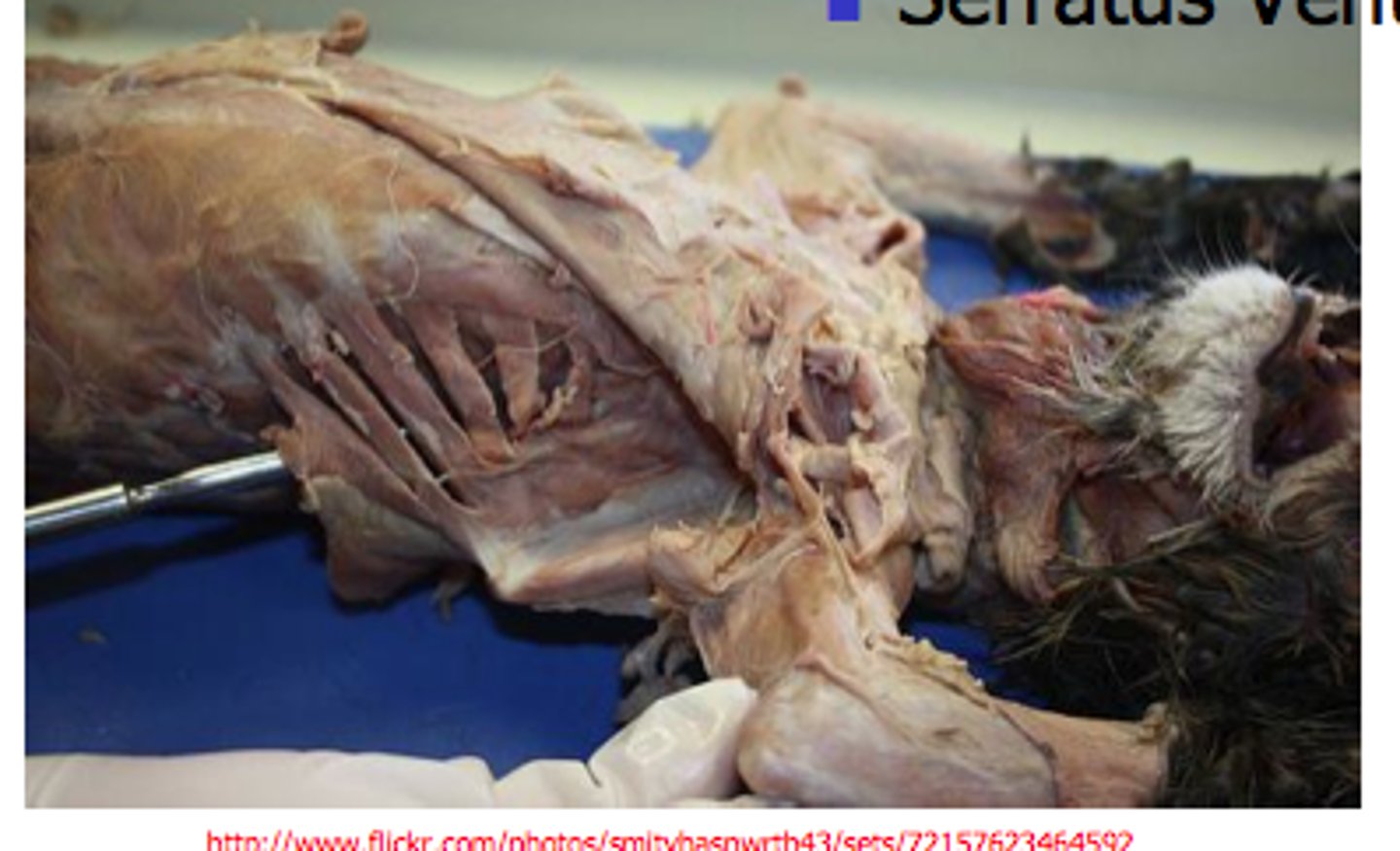 <p>name this muscle (the silver tool is kind of pointing to is in the left middle of screen)</p>