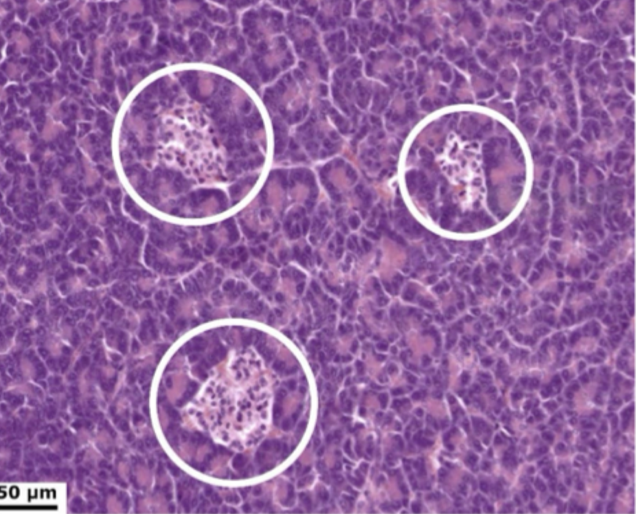 <ol start="4"><li><p>Kan ikke skelnes i HE men via immunhistokemi</p></li></ol><p></p>