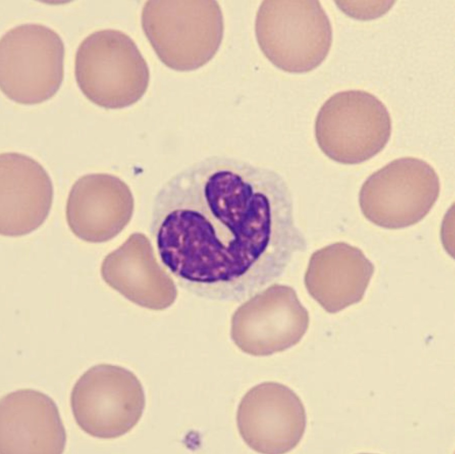 <p>What is this neutrophil showing?</p>