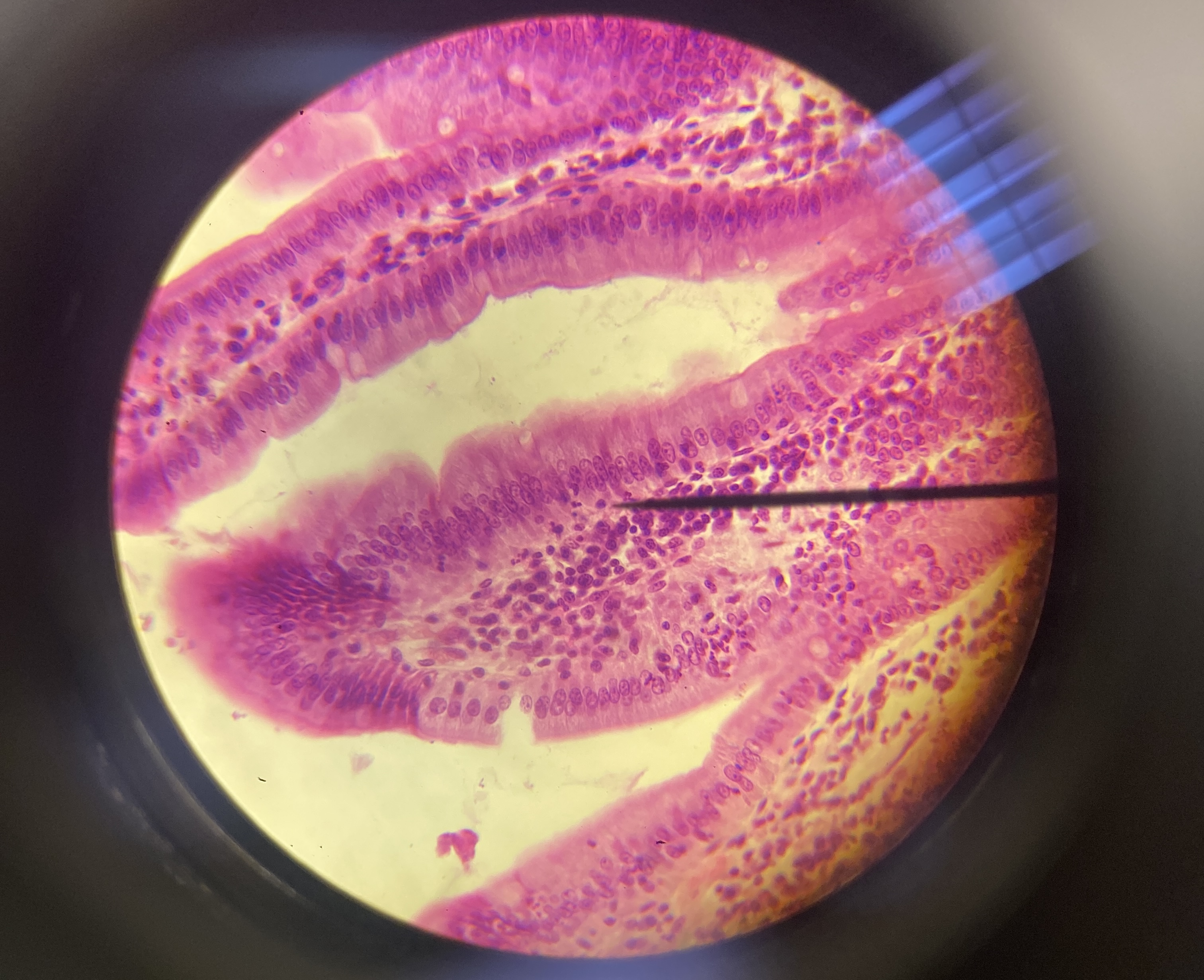 <p>simple columnar epithelium</p>