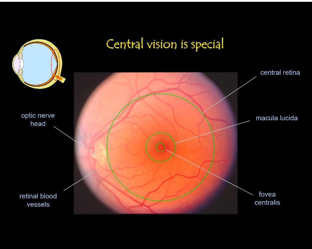 <p></p><ul><li><p><span>Location</span></p><ul><li><p><span>Central retina includes the macula.</span></p></li><li><p><span>The very centre is the fovea centralis.</span></p></li></ul></li></ul><p></p><p></p><ul><li><p><span>Excellent sampling array</span></p><ul><li><p><span>Cones are small, densely packed, and regularly spaced.</span></p></li><li><p><span>Each cone samples a tiny part of the image.</span></p></li></ul></li></ul><p></p><ul><li><p><span>Minimal convergence</span></p><ul><li><p><span>Often 1 cone → 1 bipolar → 1 ganglion cell.</span></p></li><li><p><span>Signals stay separate instead of being pooled.</span></p></li></ul></li></ul><p></p><p></p><ul><li><p><span>Reduced image blur</span></p><ul><li><p><span>Inner retinal layers are pushed aside at the foveal pit.</span></p></li><li><p><span>Light reaches cones with minimal scattering.</span></p></li></ul></li></ul><p></p><p></p><ul><li><p><span>Functional outcome</span></p><ul><li><p><span>Very high acuity (sharp vision).</span></p></li><li><p><span>Essential for reading, recognising faces, colour vision.</span></p></li></ul></li></ul><p></p><p></p><p><span><strong>Anatomical landmarks (fundus image)</strong></span></p><ul><li><p><span>Optic nerve head</span></p><ul><li><p><span>Where ganglion cell axons leave the eye.</span></p></li><li><p><span>No photoreceptors here (blind spot).</span></p></li></ul></li></ul><p></p><ul><li><p><span>Macula</span></p><ul><li><p><span>Central retinal region specialised for detail.</span></p></li></ul></li></ul><p></p><ul><li><p><span>Fovea</span></p><ul><li><p><span>Centre of the macula.</span></p></li><li><p><span>Point of maximum visual acuity.</span></p></li></ul></li></ul><p></p><ul><li><p><span>Retinal blood vessels</span></p><ul><li><p><span>Sparse in the fovea to avoid blocking light.</span></p></li></ul></li></ul><p></p><p></p>