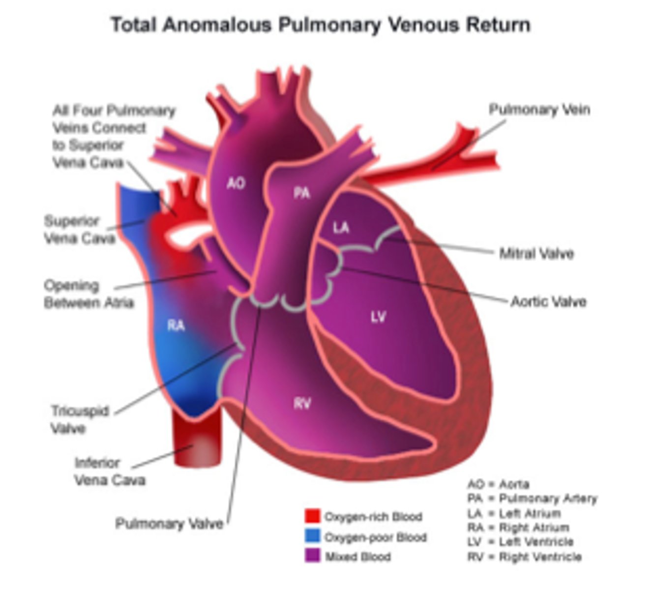 <p>The amount of blood returned to the heart by the veins</p>